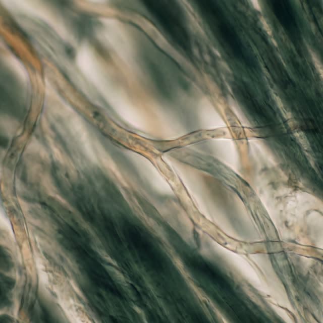 Fine vessels threading between muscle fibres under a microscope